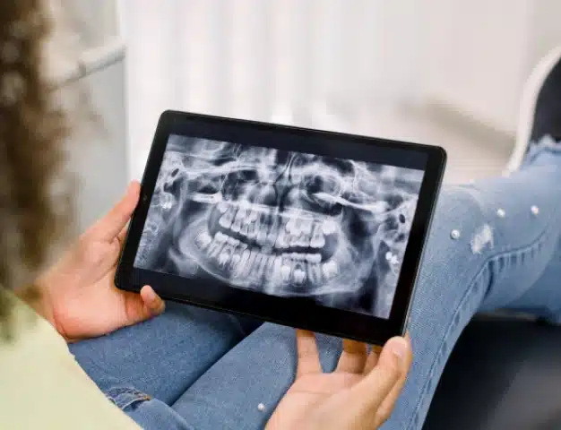 Patient viewing a panoramic dental X-ray of their teeth and jaw on a digital tablet