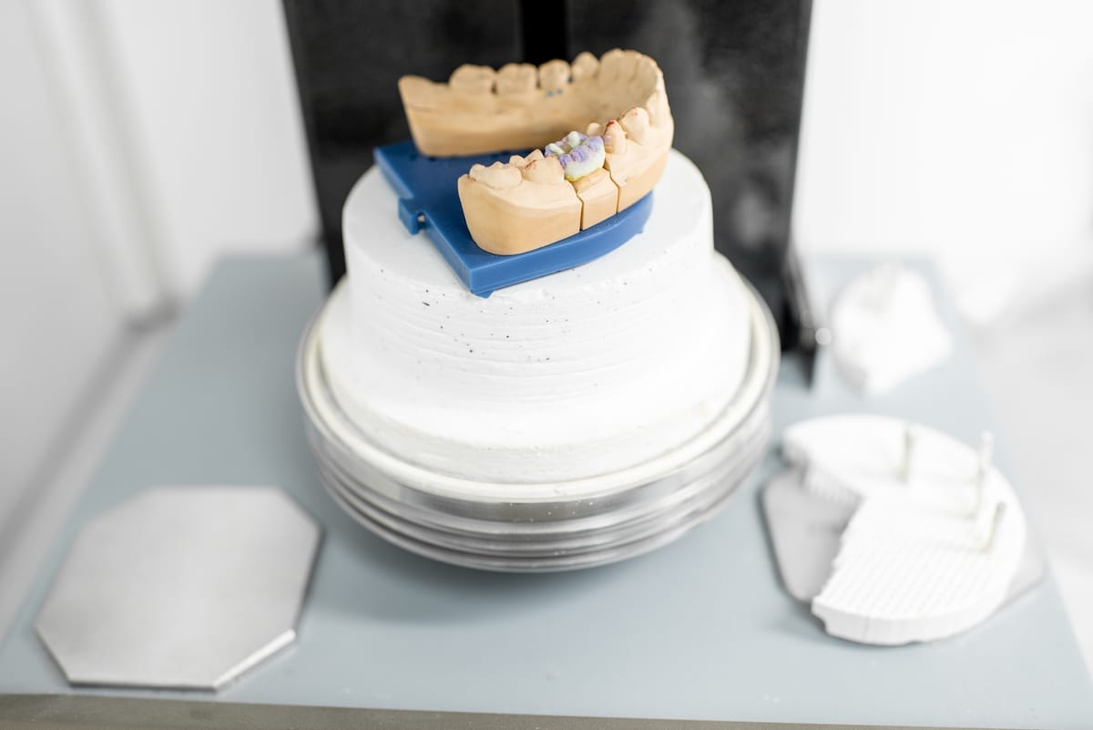 Dental Crowns in Alameda