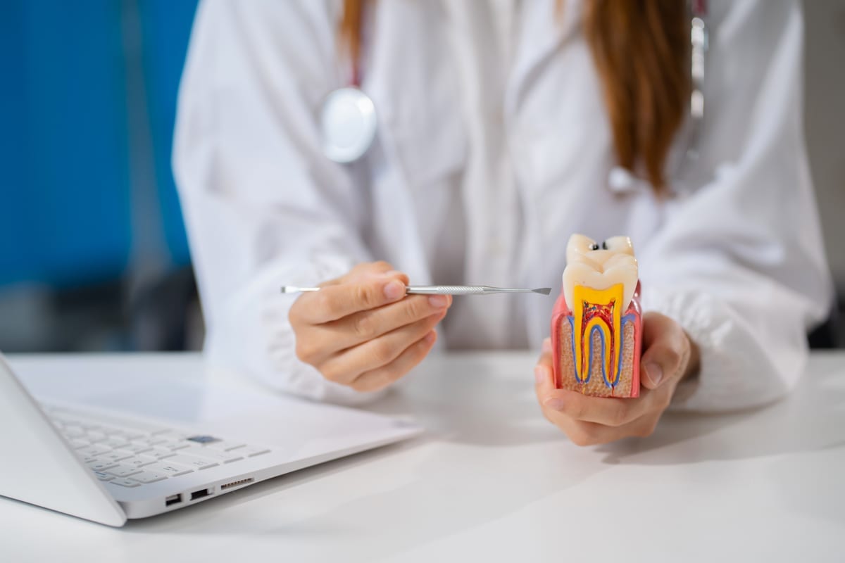 Root Canal Treatment in Burien