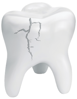 Tooth Crack: What is emergency dentistry?