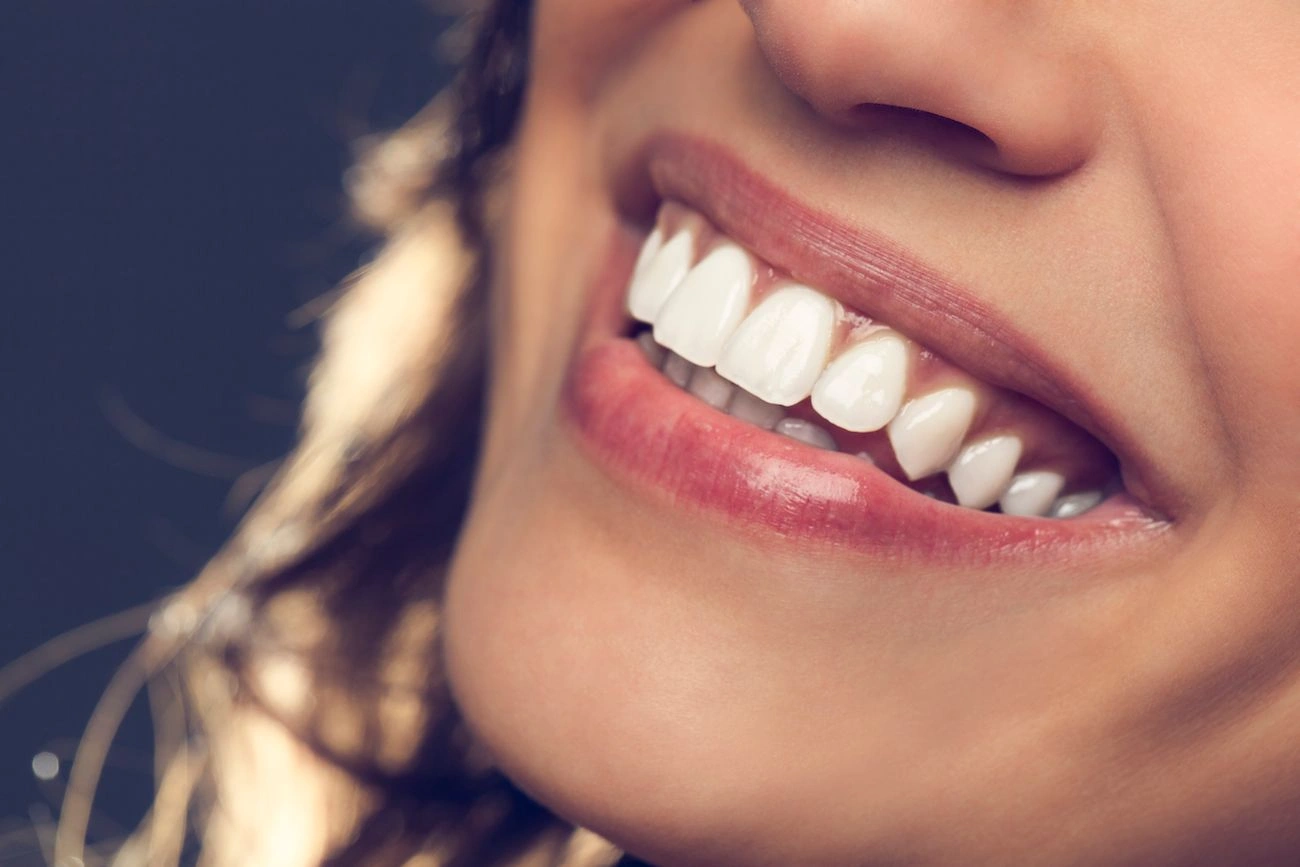 Cosmetic Dental Procedures on the Rise