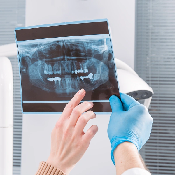 Digital X-rays
