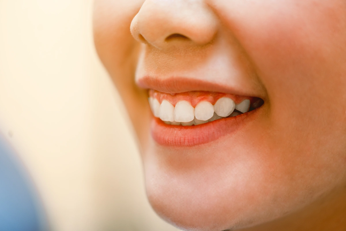 Gum Health: What To Know