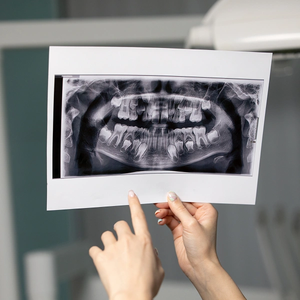 Panoramic X-Rays