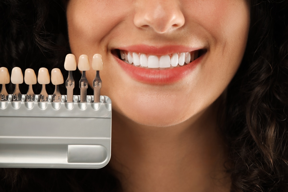 Teeth-Whitening-in-Waukegan