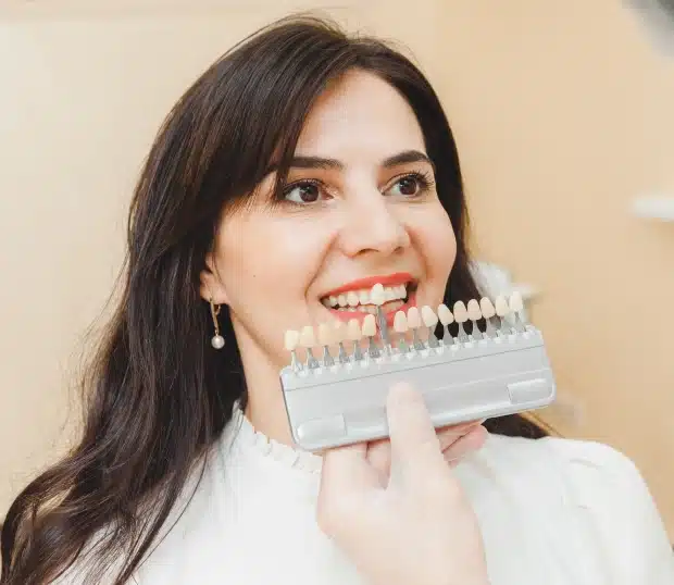 Dental Veneers