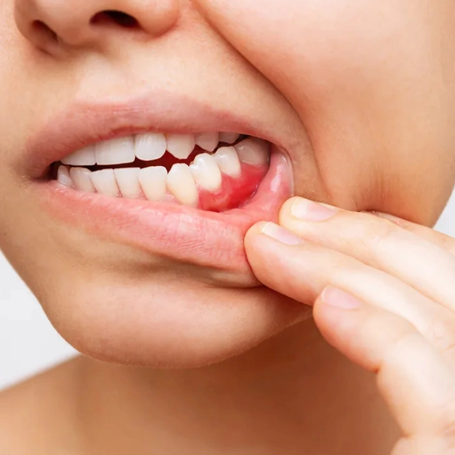 preventive dentistry services in Brookline MA
