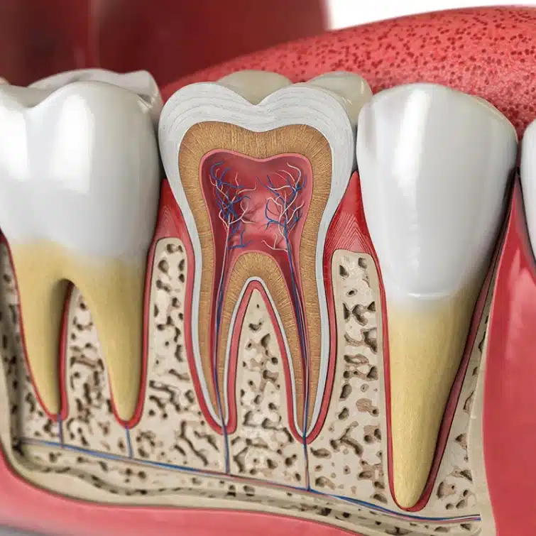 root canal in brookline