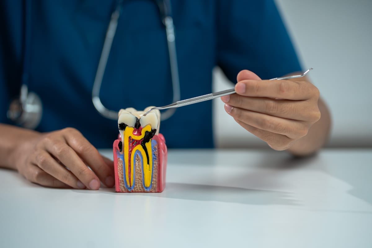 Root Canal Treatment in Brookline