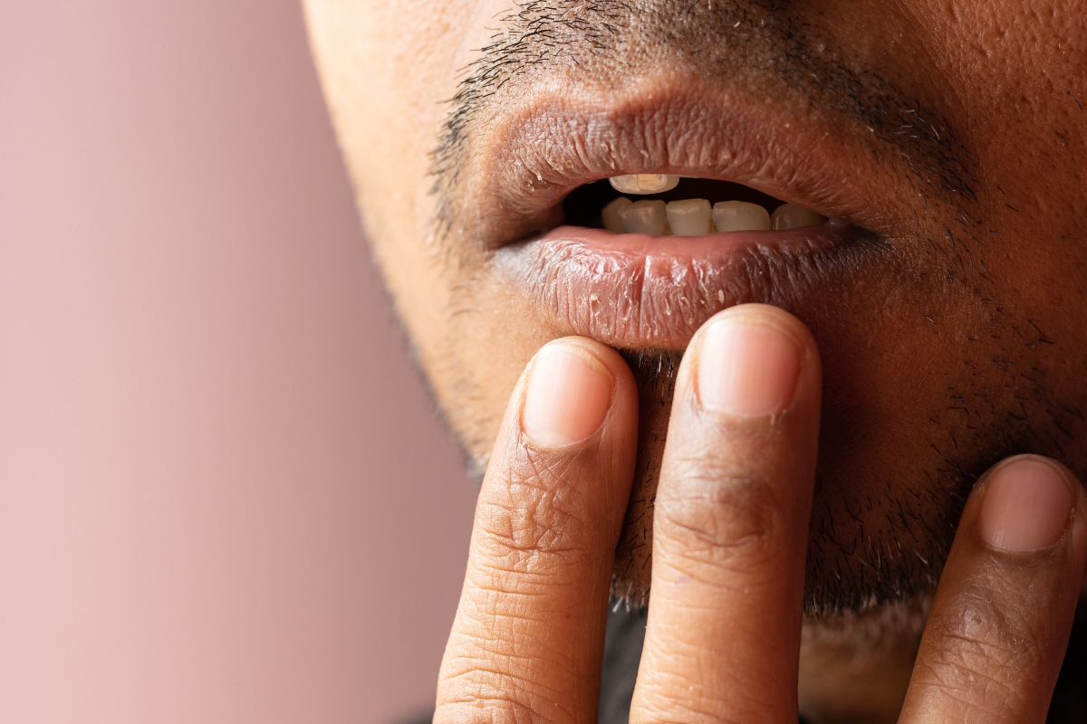 Tips to Deal with Dry Mouth