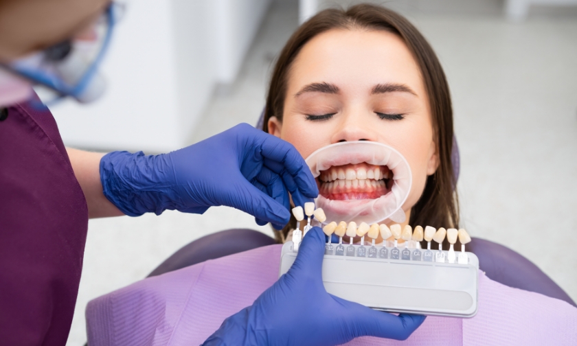fix gaps, chips & stains with veneers in bedford