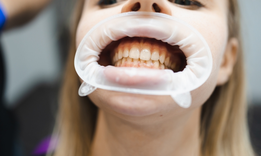 hidden costs of using teeth to open packages