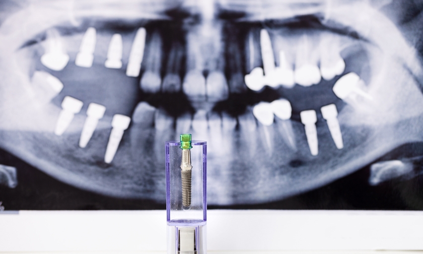 all-on-4 dental implants bedford