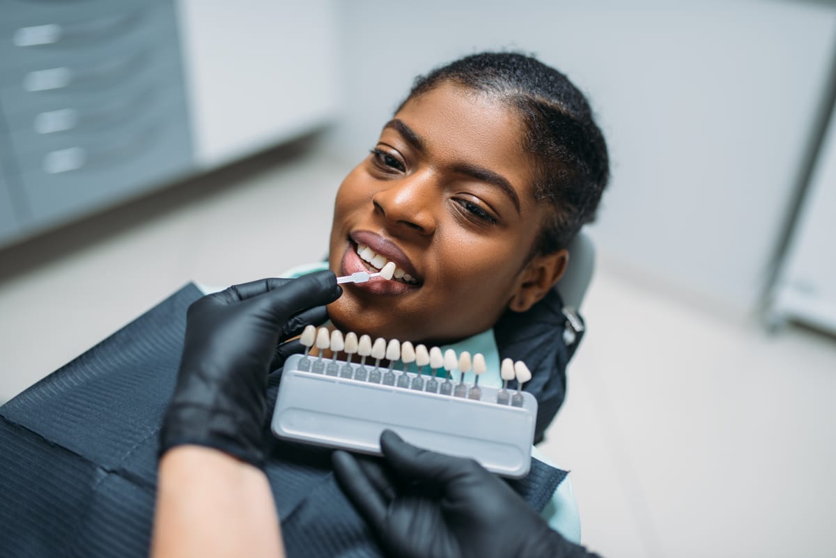 Veneers in Pasadena