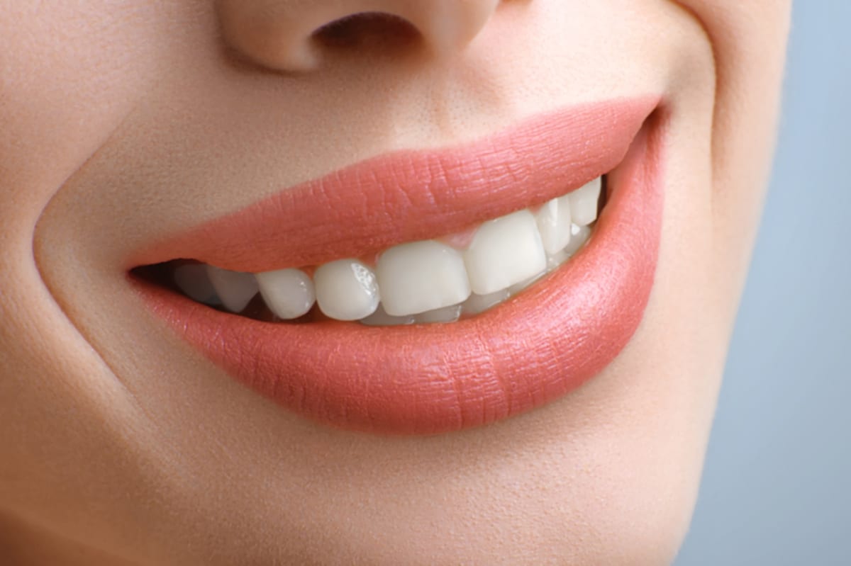 Teeth Whitening in Clearwater