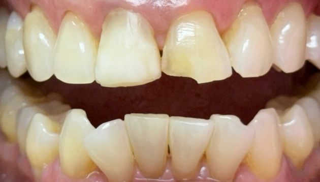 Cosmetic dentistry before treatment results