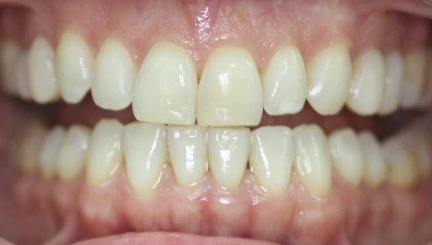Professional cosmetic dentistry before treatment results