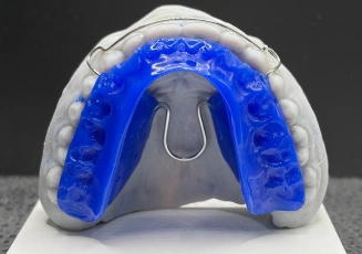 Blue dental appliance retainer