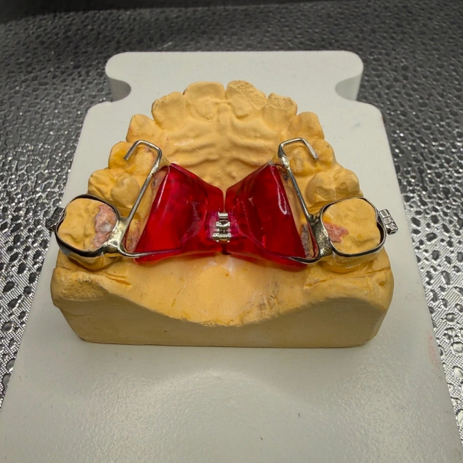 Orthodontic space maintainer