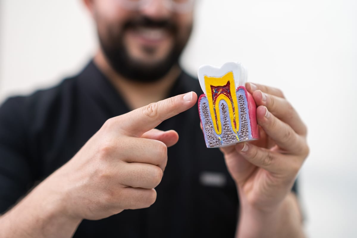 Root Canal Treatment in Plantation