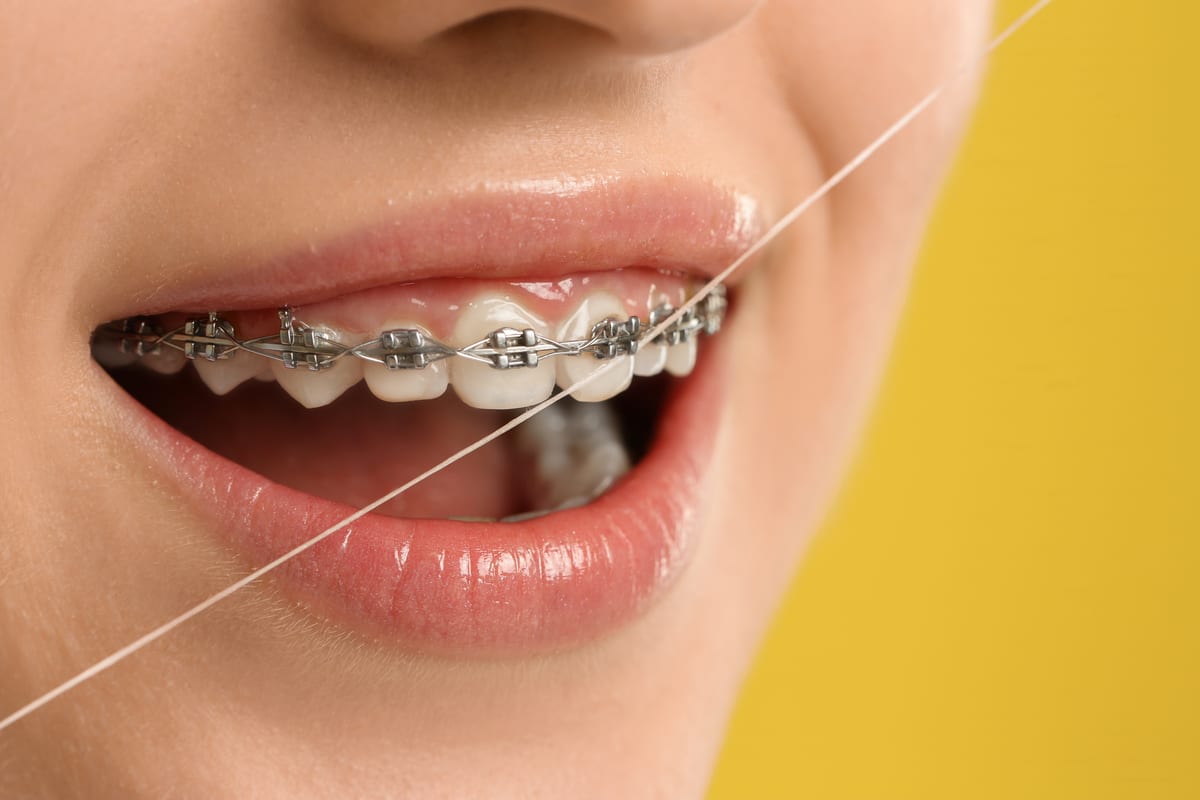Orthodontics in Plantation