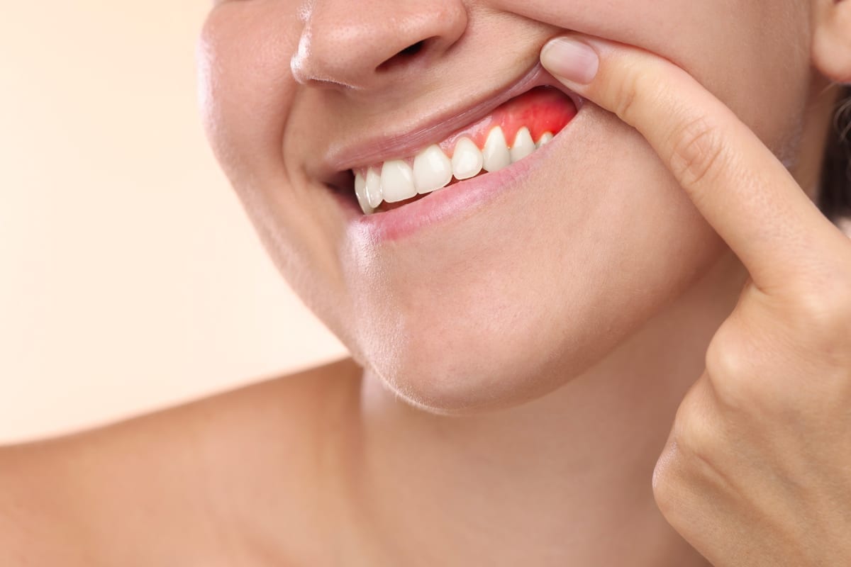 Periodontal Care in Plantation