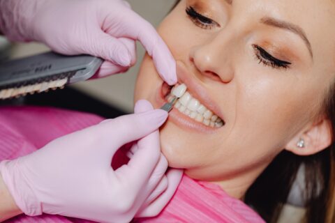 Porcelain Veneers in Boynton Beach