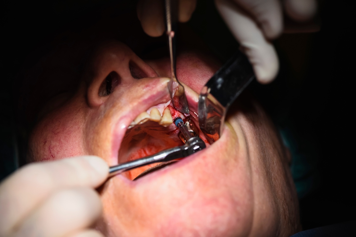 How Emergency Dentistry Helps Restore Your Oral Health Fast