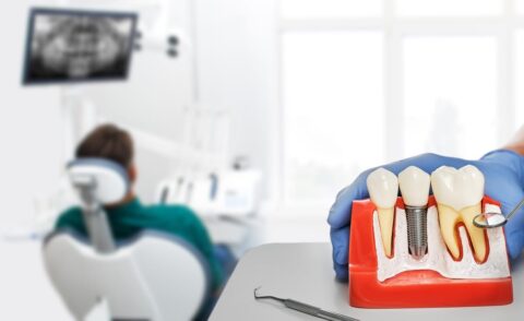 Full-Mouth Restoration in Boynton Beach