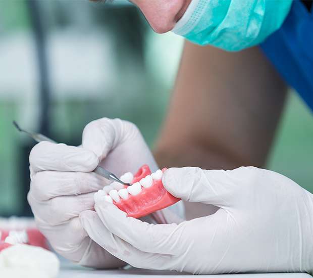 Boynton Beach Partial Dentures for Back Teeth