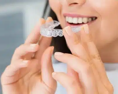 invisalign for teens
