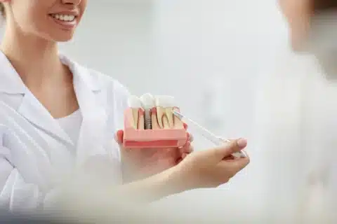 dental implants in boynton beach