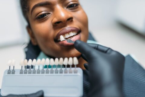 Veneers in Boynton Beach