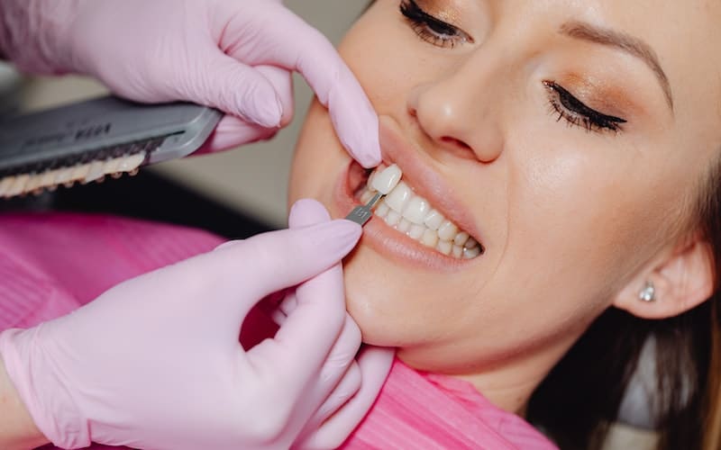 Dental Veneers - Burton Family Dental, MI