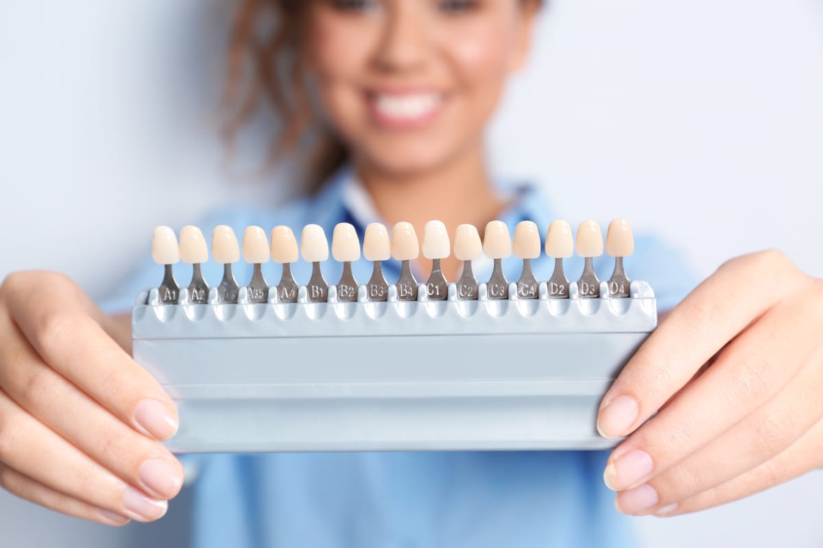 Veneers in Burton