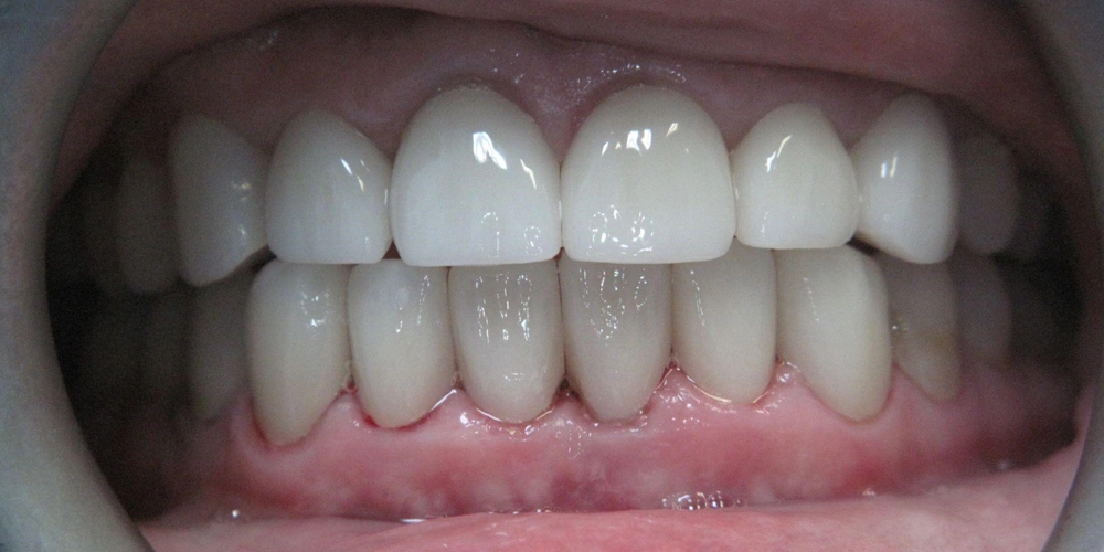 Dental stories after 2 Camarillo Premier Dental, Dental office 1000 by 500 pixels