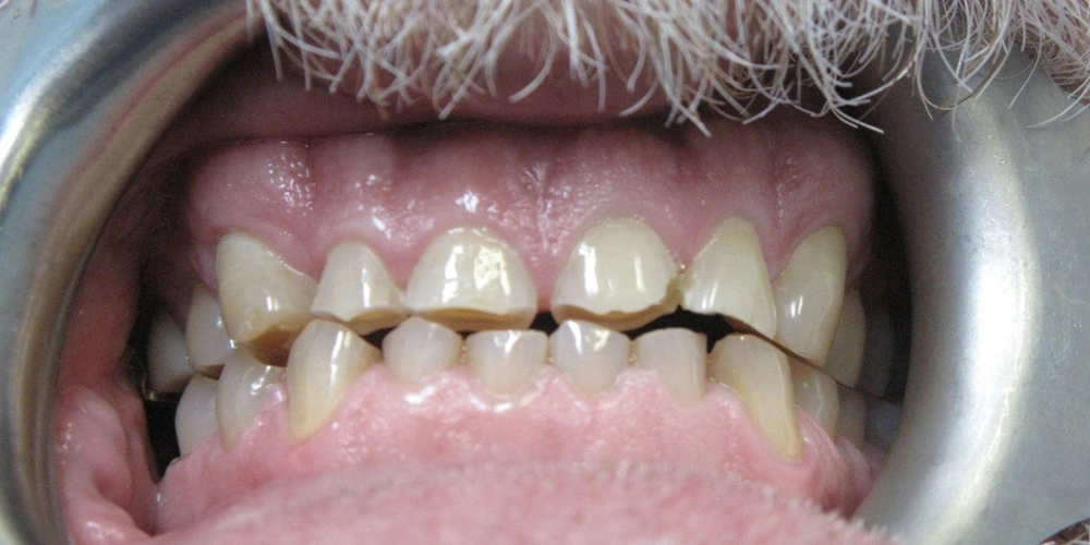 Dental stories before 2, Camarillo Premier Dental, Dental office 1000 by 500 pixels