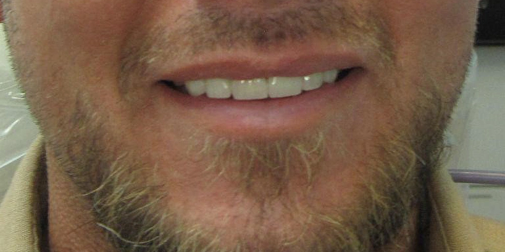 Dental stories after 3, Camarillo Premier Dental, Dental office 1000 by 500 pixels