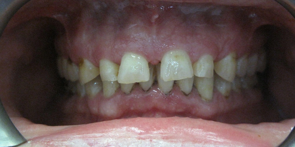 Dental stories before 3, Camarillo Premier Dental, Dental office 1000 by 500 pixels