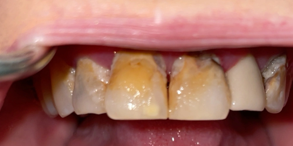 Dental stories before 4, Camarillo Premier Dental, Dental office 1000 by 500 pixels