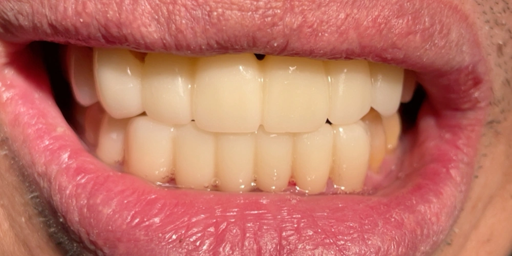 Dental stories after 5, Camarillo Premier Dental, Dental office 1000 by 500 pixels