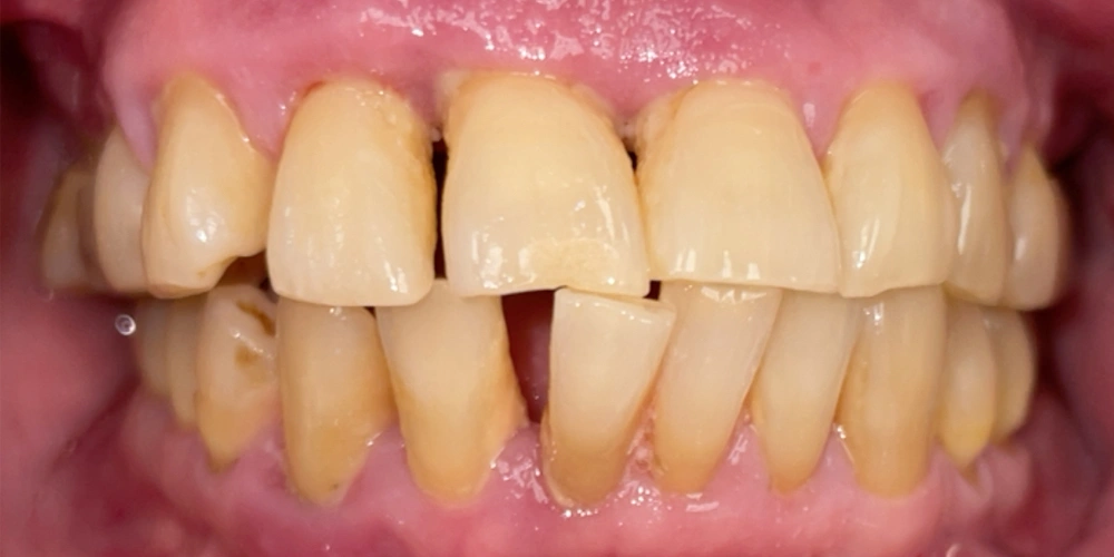 Dental stories before 5, Camarillo Premier Dental, Dental office 1000 by 500 pixels