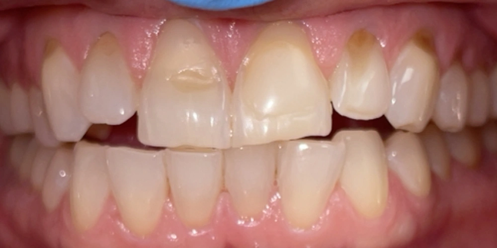 Dental stories before 6, Camarillo Premier Dental, Dental office 1000 by 500 pixels