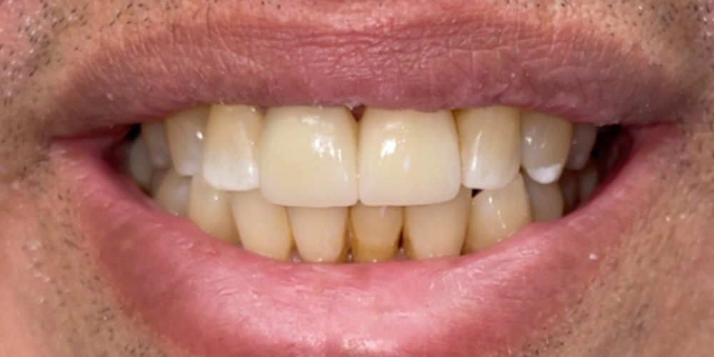 Dental stories after 7, Camarillo Premier Dental, Dental office 1000 by 500 pixels