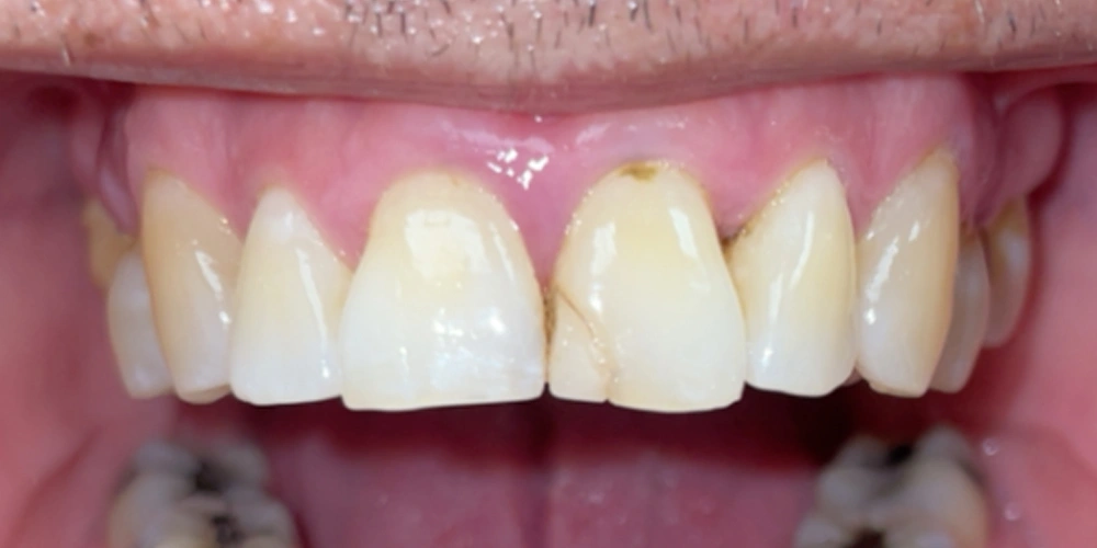Dental stories before 7, Camarillo Premier Dental, Dental office 1000 by 500 pixels