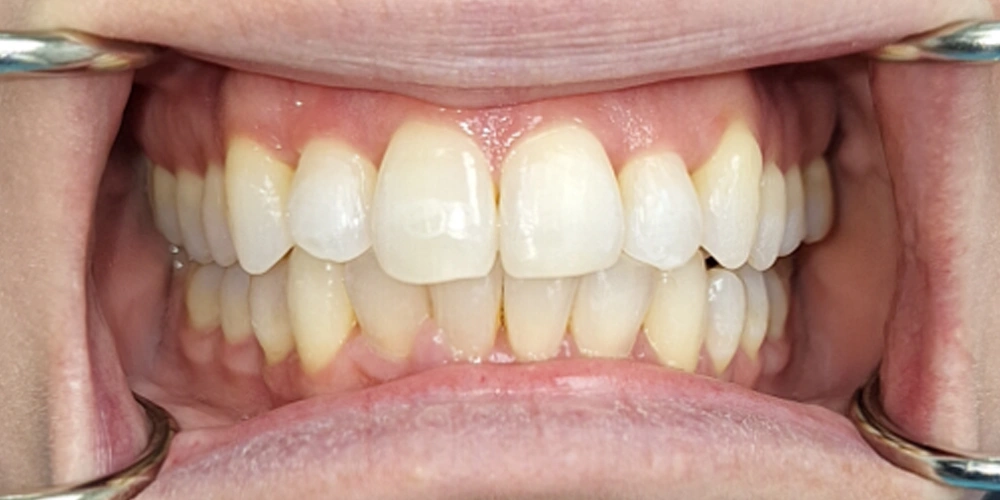 Dental stories after 8, Camarillo Premier Dental, Dental office 1000 by 500 pixels