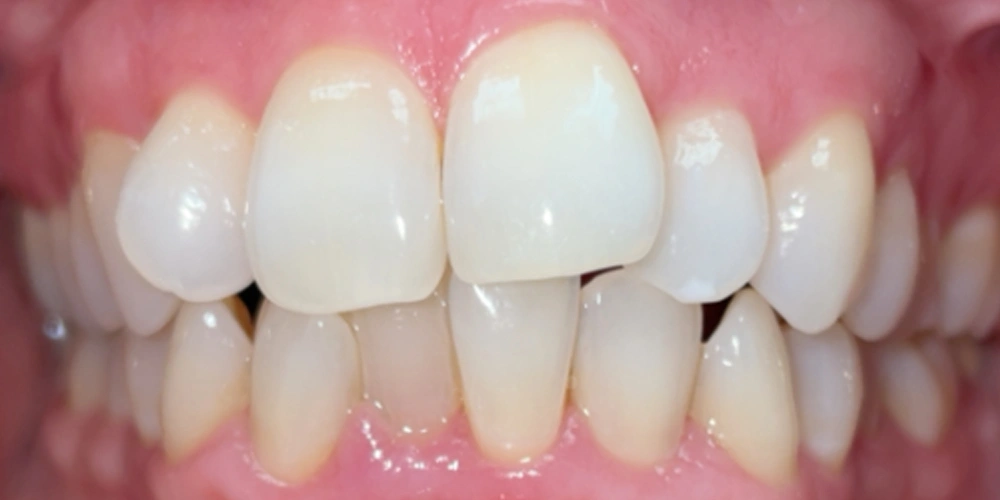 Dental stories before 8, Camarillo Premier Dental, Dental office 1000 by 500 pixels