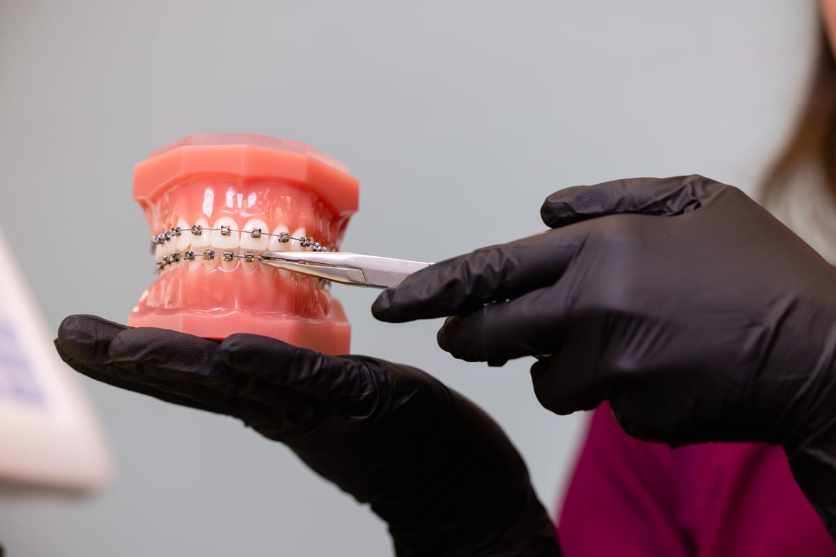 Orthodontics in Camarillo