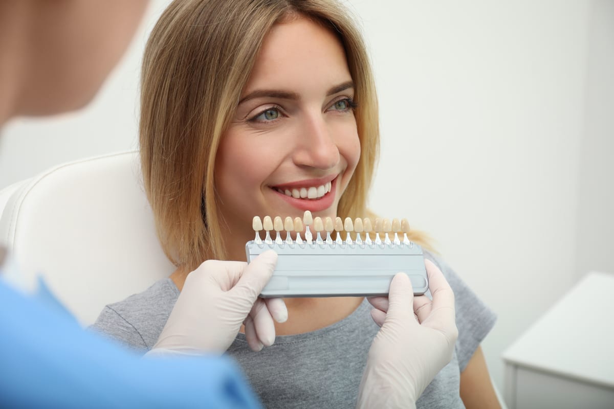 Veneers in Camarillo