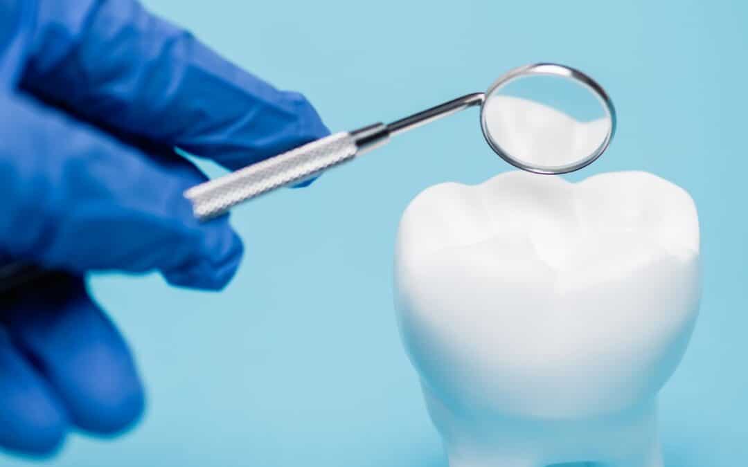 How to Know If Your Tooth’s Enamel Is Damaged
